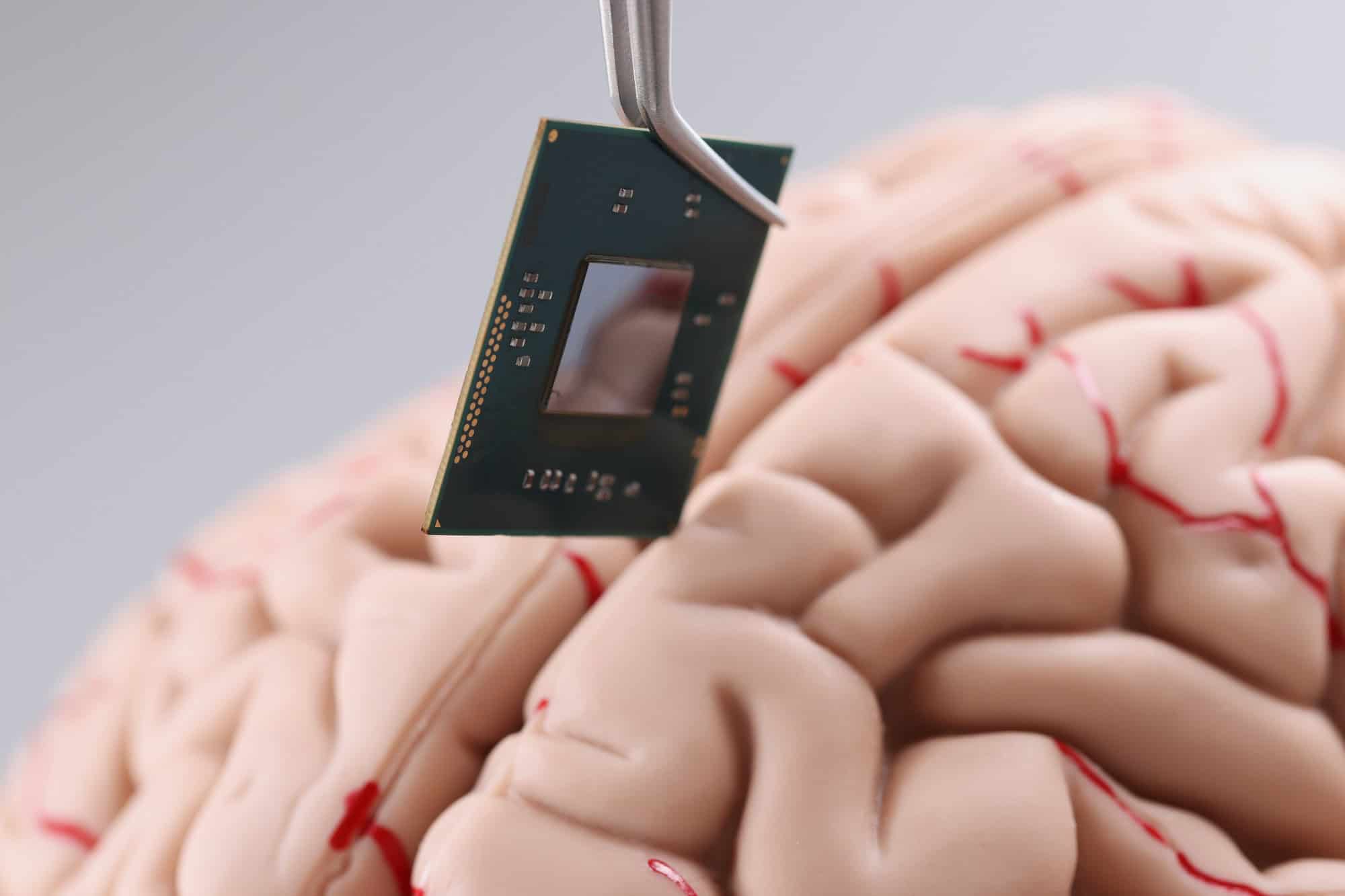Implante cerebral invasivo é autorizado para uso comercial na China